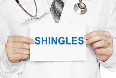 Shingles