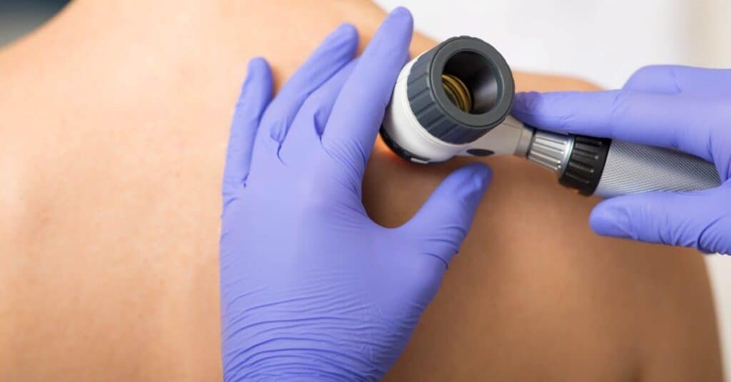 Bare shoulder being examined