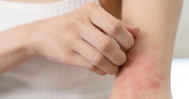Ozempic Skin Side Effects